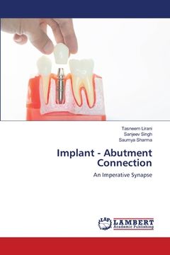 portada Implant - Abutment Connection (en Inglés)