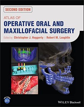 portada Atlas of Operative Oral and Maxillofacial Surgery (in English)