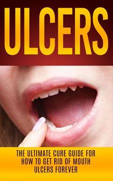 portada Ulcers: The Ultimate Cure Guide for How to Get Rid of Mouth Ulcers Instantly (en Inglés)
