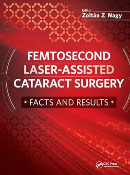 portada Femtosecond Laser-Assisted Cataract Surgery: Facts and Results (en Inglés)
