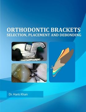 portada Orthodontic Brackets: Selection, Placement and Debonding (en Inglés)