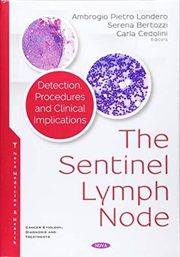 portada The Sentinel Lymph Node Detection, Procedures and Clinical Implications Cancer Etiology Diagnosis and