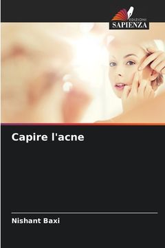 portada Capire l'acne (in Italian)