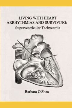 portada Living with Heart Arrhythmias and Surviving: Supraventricular Tachycardia (en Inglés)
