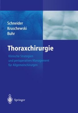 portada Thoraxchirurgie: Klinische Strategien und perioperatives Management für Allgemeinchirurgen (German Edition)