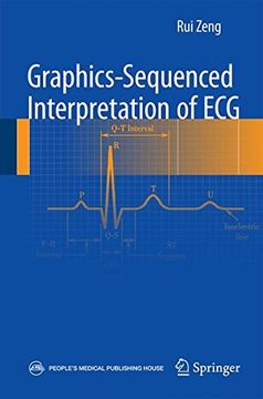 portada Graphics-sequenced interpretation of ECG