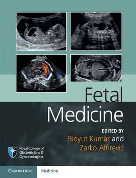 portada Fetal Medicine (Royal College of Obstetricians and Gynaecologists Advanced Skills) (en Inglés)