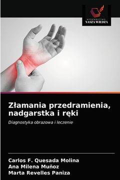 portada Zlamania przedramienia, nadgarstka i ręki (en Polaco)