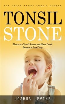 portada Tonsil Stones: The Truth about Tonsil Stones (Eliminate Tonsil Stones and Have Fresh Breath in Just Days!) (in English)