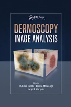 portada Dermoscopy Image Analysis (en Inglés)