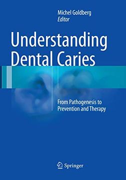 portada Understanding Dental Caries: From Pathogenesis to Prevention and Therapy (en Inglés)