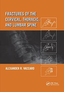 portada Fractures of the Cervical, Thoracic, and Lumbar Spine (in English)