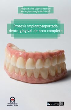 portada Prótesis implantosoportada dento-gingival de arco completo
