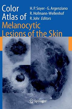 portada Color Atlas of Melanocytic Lesions of the Skin 