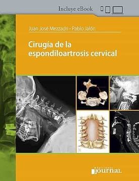 portada Cirugia de la Espondiloartrosis Cervical (Incluye E-Book)