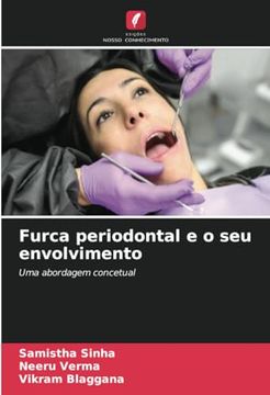 portada Furca Periodontal e o seu Envolvimento: Uma Abordagem Concetual (en Portugués)