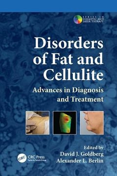 portada Disorders of fat and Cellulite: Advances in Diagnosis and Treatment (Series in Cosmetic and Laser Therapy)