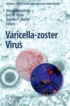 portada varicella-zoster virus (in English)