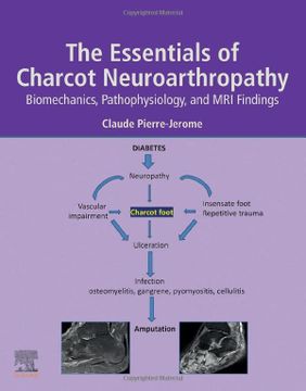 portada The Essentials of Charcot Neuroarthropathy: Biomechanics, Pathophysiology, and mri Findings (en Inglés)