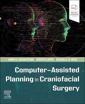 portada Computer-Assisted Planning in Craniofacial Surgery (en Inglés)