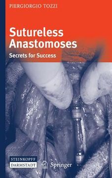 portada Sutureless Anastomoses: Secrets for Success (en Inglés)