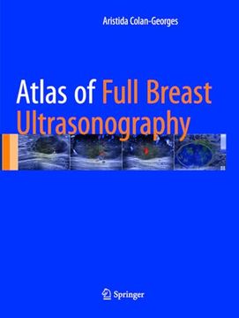 portada Atlas of Full Breast Ultrasonography (en Inglés)