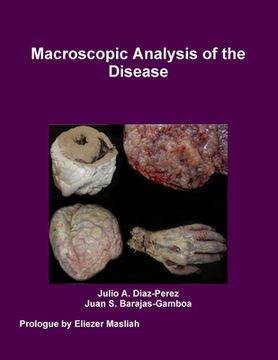 portada Macroscopic Analysis of the Disease