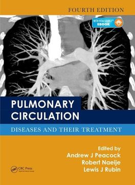 portada Pulmonary Circulation: Diseases and Their Treatment, Fourth Edition