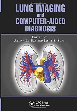 portada Lung Imaging and Computer Aided Diagnosis (en Inglés)