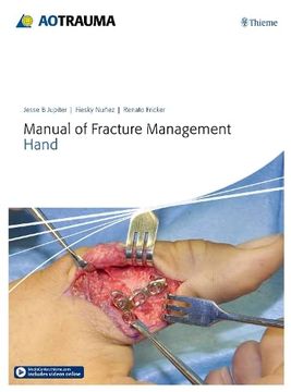 portada Manual of Fracture Management - Hand (en Inglés)