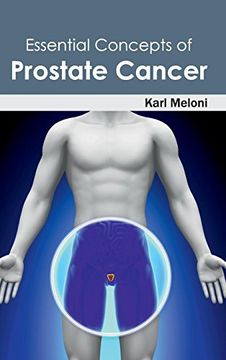 portada Essential Concepts of Prostate Cancer (en Inglés)
