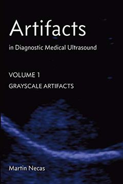 portada Artifacts in Diagnostic Medical Ultrasound: Grayscale Artifacts (en Inglés)