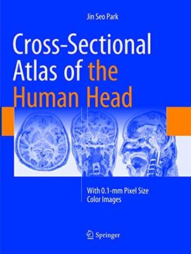portada Cross-Sectional Atlas of the Human Head: With 0.1-MM Pixel Size Color Images (en Inglés)
