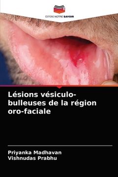 portada Lésions vésiculo-bulleuses de la région oro-faciale (en Francés)
