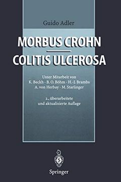portada Morbus Crohn - Colitis Ulcerosa (en Alemán)