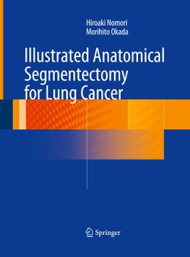 portada Illustrated Anatomical Segmentectomy for Lung Cancer (en Inglés)