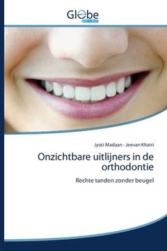 portada Onzichtbare uitlijners in de orthodontie