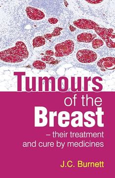portada Tumours of the Breast and Their Treatment and Cure by Medicines: 1 (en Inglés)