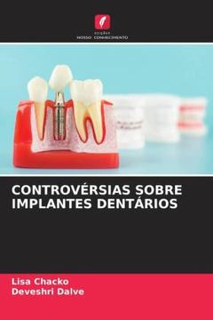 portada Controvã â Rsias Sobre Implantes Dentã â Rios