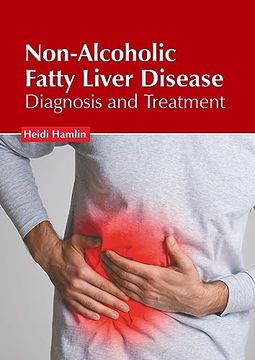 portada Non-Alcoholic Fatty Liver Disease: Diagnosis and Treatment (in English)
