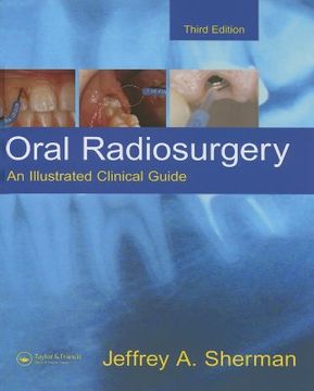 portada Oral Radiosurgery: An Illustrated Clinical Guide (en Inglés)