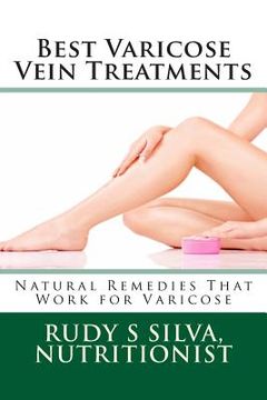 portada Best Varicose Vein Treatments: Natural Remedies That Work For Varicose (en Inglés)
