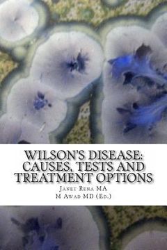 portada Wilson's Disease: Causes, Tests and Treatment Options (en Inglés)