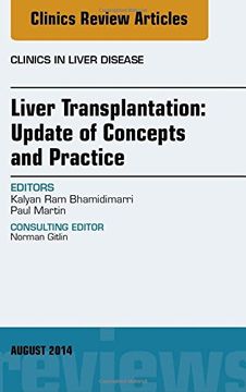 portada Liver Transplantation: Update of Concepts and Practice, An Issue of Clinics in Liver Disease, 1e (The Clinics: Internal Medicine)