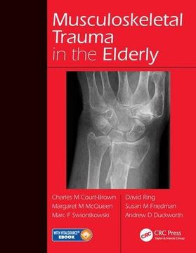 portada Musculoskeletal Trauma in the Elderly (en Inglés)