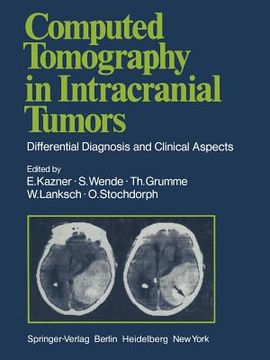 portada computed tomography in intracranial tumors: differential diagnosis and clinical aspects