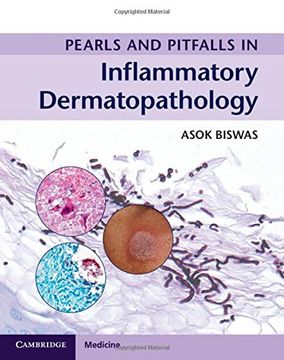portada Pearls and Pitfalls in Inflammatory Dermatopathology (en Inglés)
