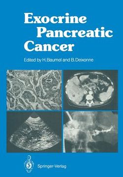 portada exocrine pancreatic cancer (en Inglés)