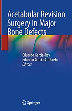 portada Acetabular Revision Surgery in Major Bone Defects (en Inglés)