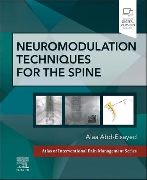 portada Neuromodulation Techniques for the Spine: A Volume in the Atlas of Interventional Pain Management Series 